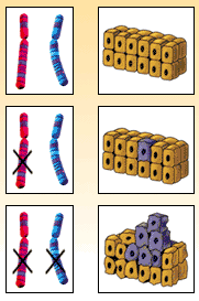 How Sporadic Cancer Develops