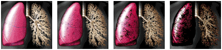 Lungs